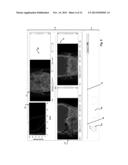 Customization of a Dose Distribution Setting for a Technical Appliance for     Tumour Therapy diagram and image