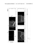 Customization of a Dose Distribution Setting for a Technical Appliance for     Tumour Therapy diagram and image