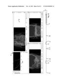 Customization of a Dose Distribution Setting for a Technical Appliance for     Tumour Therapy diagram and image