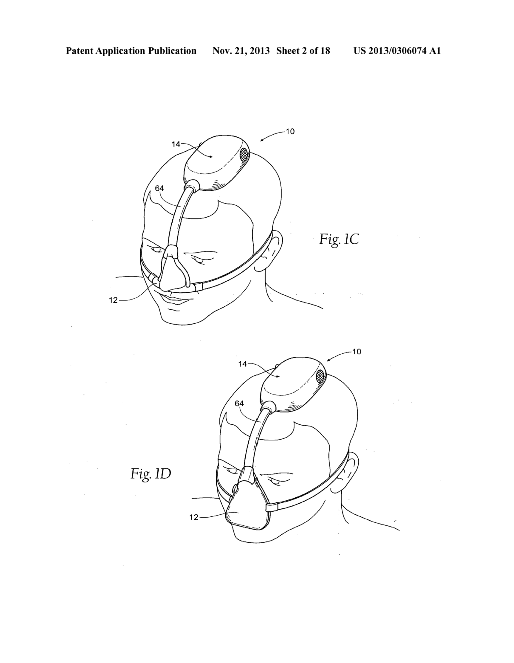 SELF-CONTAINED, INTERMITTENT POSITIVE AIRWAY PRESSURE SYSTEMS AND METHODS     FOR TREATING SLEEP APNEA, SNORING, AND OTHER RESPIRATORY DISORDERS - diagram, schematic, and image 03