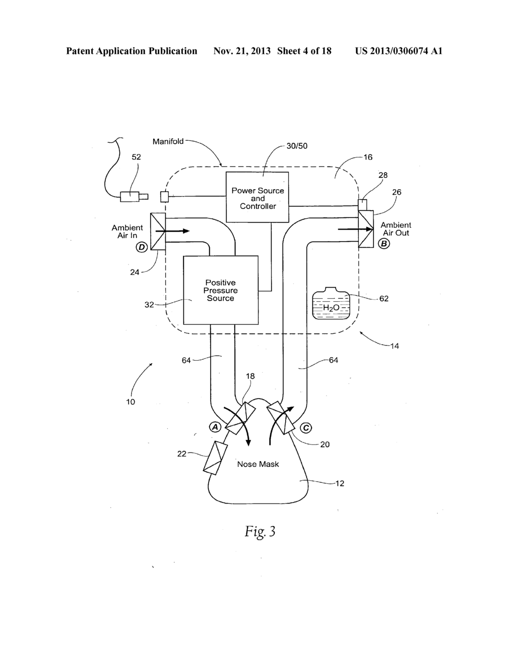 SELF-CONTAINED, INTERMITTENT POSITIVE AIRWAY PRESSURE SYSTEMS AND METHODS     FOR TREATING SLEEP APNEA, SNORING, AND OTHER RESPIRATORY DISORDERS - diagram, schematic, and image 05