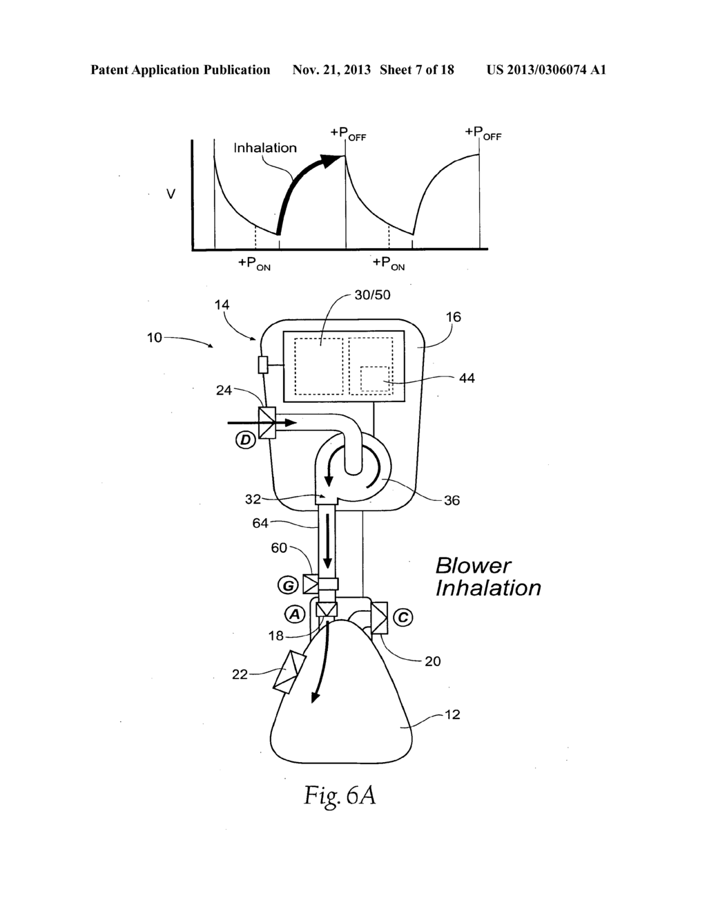 SELF-CONTAINED, INTERMITTENT POSITIVE AIRWAY PRESSURE SYSTEMS AND METHODS     FOR TREATING SLEEP APNEA, SNORING, AND OTHER RESPIRATORY DISORDERS - diagram, schematic, and image 08