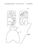 METHOD AND SYSTEM FOR SIZING AN ORAL APPLIANCE USING OVERLAYS diagram and image