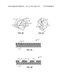 METHOD AND SYSTEM FOR SIZING AN ORAL APPLIANCE USING OVERLAYS diagram and image