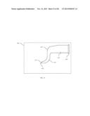 Vacuum Attachment System diagram and image