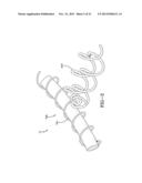 SYSTEM FOR NON-PNEUMATIC SUPPORT OF A VEHICLE diagram and image