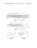 METHOD OF REMOVING AN OUT-OF-TOLERANCE AREA IN A COMPOSITE STRUCTURE diagram and image