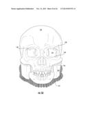 Support Structures and Deposition Techniques for 3D Printing diagram and image