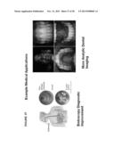 SENSOR-SYNCHRONIZED SPECTRALLY-STRUCTURED-LIGHT IMAGING diagram and image