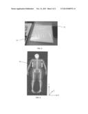 Apparatus and Method for Detecting Lymphedema Using X-Ray Scans diagram and image