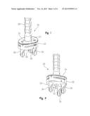 PERIPHERAL PEG DRILL COMPONENT diagram and image