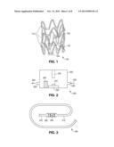 REDUCED TEMPERATURE STERILIZATION OF STENTS diagram and image