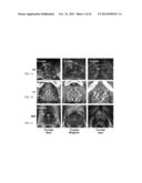 Seeds and Markers for Use in Imaging diagram and image