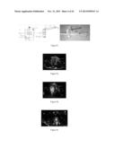 Seeds and Markers for Use in Imaging diagram and image