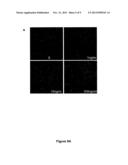 TAM RECEPTORS AND TAM RECEPTOR LIGANDS IN DETECTION AND MODULATION OF     NEUROPATHOLOGICAL DISEASE diagram and image