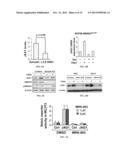 JAGGED1 AS A MARKER AND THERAPEUTIC TARGET FOR BREAST CANCER BONE     METASTASIS diagram and image