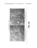 Immortalization of Epithelial Cells and Methods of Use diagram and image