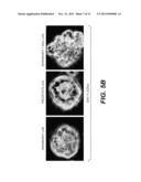 Immortalization of Epithelial Cells and Methods of Use diagram and image