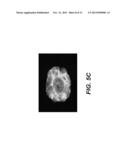 Immortalization of Epithelial Cells and Methods of Use diagram and image