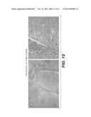 Immortalization of Epithelial Cells and Methods of Use diagram and image