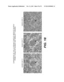 Immortalization of Epithelial Cells and Methods of Use diagram and image