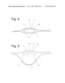 Acceleration Protective Suit diagram and image