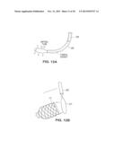 SATIATION DEVICES AND METHODS diagram and image