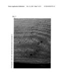 ELECTRODE PAD USED FOR IONTOPHORESIS TREATMENT diagram and image