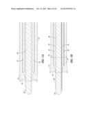 SEAL TIP CATHETER DEVICES OR METHODS diagram and image