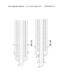 SEAL TIP CATHETER DEVICES OR METHODS diagram and image