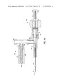 SEAL TIP CATHETER DEVICES OR METHODS diagram and image