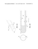 SEAL TIP CATHETER DEVICES OR METHODS diagram and image