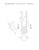 SEAL TIP CATHETER DEVICES OR METHODS diagram and image