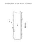 SEAL TIP CATHETER DEVICES OR METHODS diagram and image