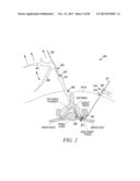 POWERED TISSUE MODIFICATION DEVICES AND METHODS diagram and image