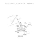 POWERED TISSUE MODIFICATION DEVICES AND METHODS diagram and image