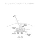 POWERED TISSUE MODIFICATION DEVICES AND METHODS diagram and image