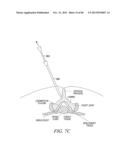 POWERED TISSUE MODIFICATION DEVICES AND METHODS diagram and image