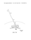 POWERED TISSUE MODIFICATION DEVICES AND METHODS diagram and image