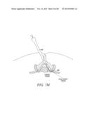 POWERED TISSUE MODIFICATION DEVICES AND METHODS diagram and image