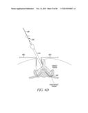 POWERED TISSUE MODIFICATION DEVICES AND METHODS diagram and image