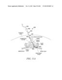 POWERED TISSUE MODIFICATION DEVICES AND METHODS diagram and image