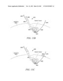 POWERED TISSUE MODIFICATION DEVICES AND METHODS diagram and image