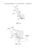 POWERED TISSUE MODIFICATION DEVICES AND METHODS diagram and image