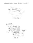 POWERED TISSUE MODIFICATION DEVICES AND METHODS diagram and image