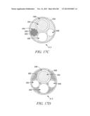 POWERED TISSUE MODIFICATION DEVICES AND METHODS diagram and image