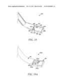 POWERED TISSUE MODIFICATION DEVICES AND METHODS diagram and image