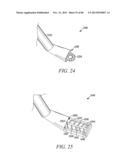 POWERED TISSUE MODIFICATION DEVICES AND METHODS diagram and image