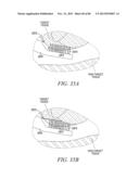 POWERED TISSUE MODIFICATION DEVICES AND METHODS diagram and image