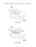 POWERED TISSUE MODIFICATION DEVICES AND METHODS diagram and image